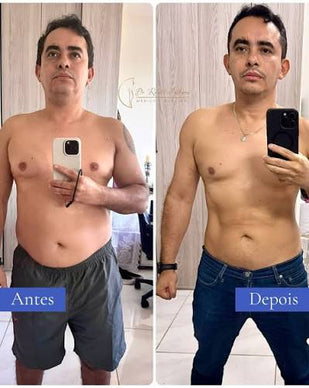 Antes e Depois