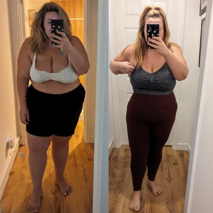 Antes e depois
